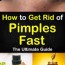 home remedies to get rid of pimples fast