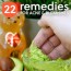 home remedies for acne pesky pimples