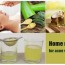 home remedies for acne scar removal