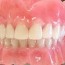 clean dentures homemade cleaner