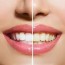 diy natural teeth whitener for a