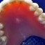 6 steps to clean dentures