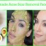 homemade acne scar removal face mask