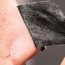 diy pore strips for blackheads 5 steps