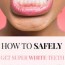 how to whiten teeth at home fast less