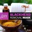 diy blackhead removal mask with