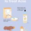 6 natural remedies for acne that