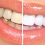 the top 3 diy teeth whitening methods