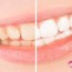 all natural diy teeth whitening paste