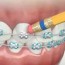 emergency orthodontic care in spring