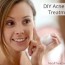 natural diy acne spot treatment works