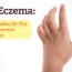 baby eczema natural remedies for this