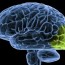 younger brains are easier to rewire