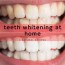 3 recipes teeth whitening at home
