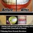 naturally white your teeth