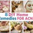 diy home remedies for acne blemishes