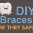 diy braces safe premier orthodontics