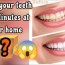 teeth whitening at home diy medizoop